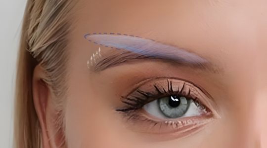 دایرکت ابرو چیست؟