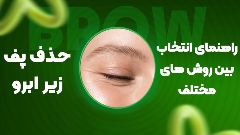 راهنمای انتخاب بین روشهای مختلف حذف پف زیر ابرو