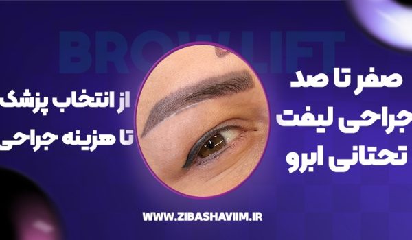 صفر تا صد جراحی لیفت تحتانی ابرو؛ از انتخاب پزشک تا هزینه جراحی