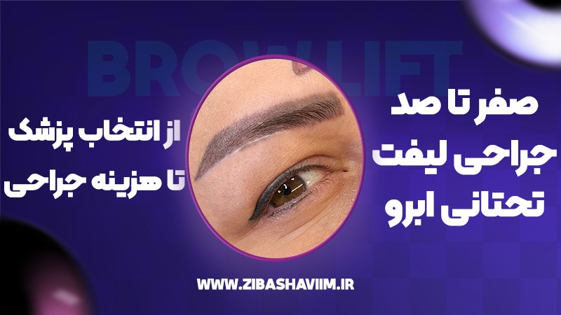 صفر تا صد جراحی لیفت تحتانی ابرو؛ از انتخاب پزشک تا هزینه جراحی