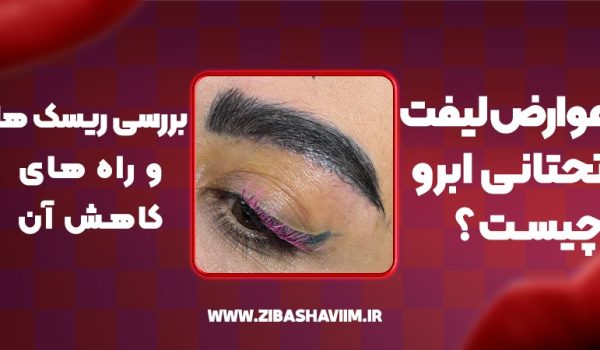 عوارض لیفت تحتانی ابرو چیست؟ بررسی ریسکها و راههای کاهش آن 1 عوارض لیفت تحتانی ابرو چیست؟ بررسی ریسکها و راههای کاهش آن