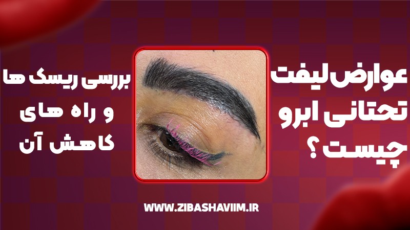 عوارض لیفت تحتانی ابرو چیست؟ بررسی ریسکها و راههای کاهش آن