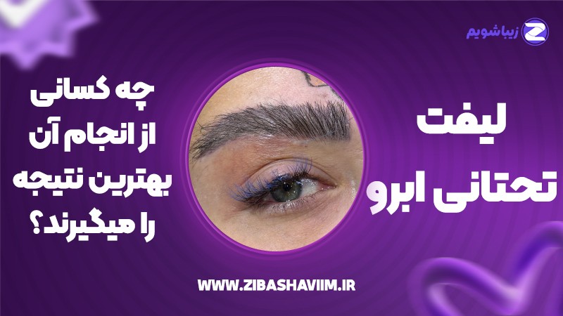 لیفت تحتانی ابرو؛ چه کسانی از انجام آن بهترین نتیجه را میگیرند؟