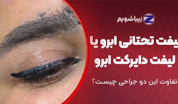 لیفت تحتانی ابرو یا لیفت دایرکت ابرو؛ تفاوت این دو جراحی چیست؟