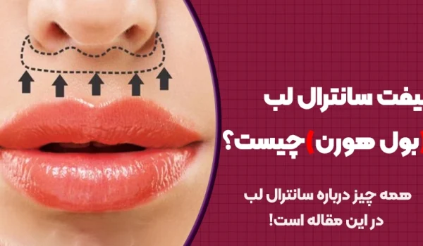 لیفت سانترال لب (بول هورن) چیست؟ 1 لیفت سانترال لب (بول هورن) چیست؟