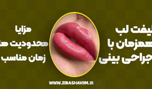 لیفت لب همزمان با جراحی بینی؛ مزایا، محدودیت‌ها و زمان مناسب