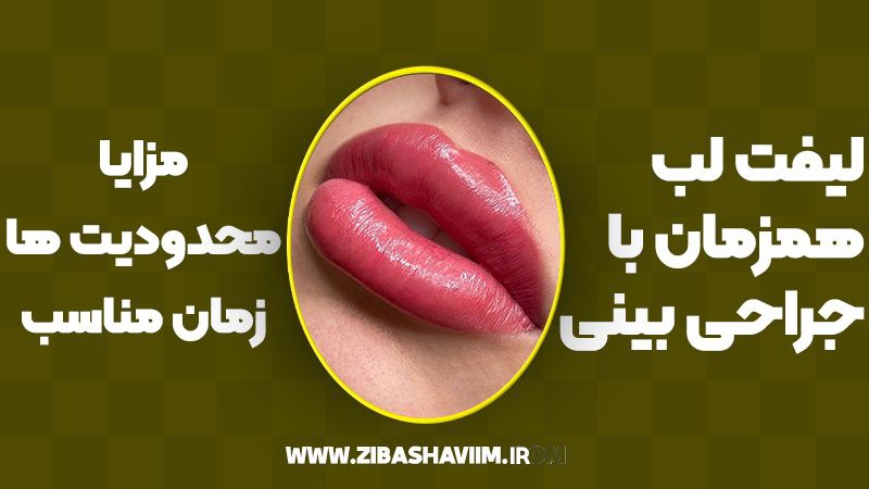 لیفت لب همزمان با جراحی بینی؛ مزایا، محدودیتها و زمان مناسب