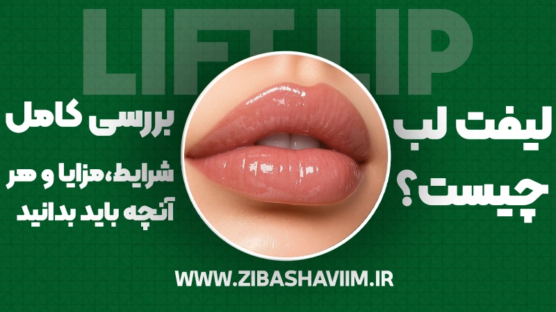 لیفت لب چیست؟ بررسی شرایط، مزایا و هر آنچه باید بدانید