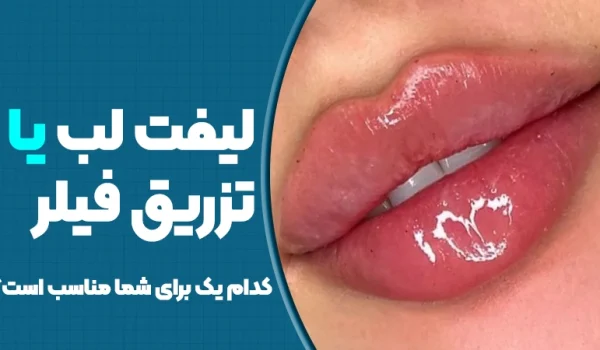 لیفت لب یا تزریق فیلر؛ کدام یک برای شما مناسب است؟