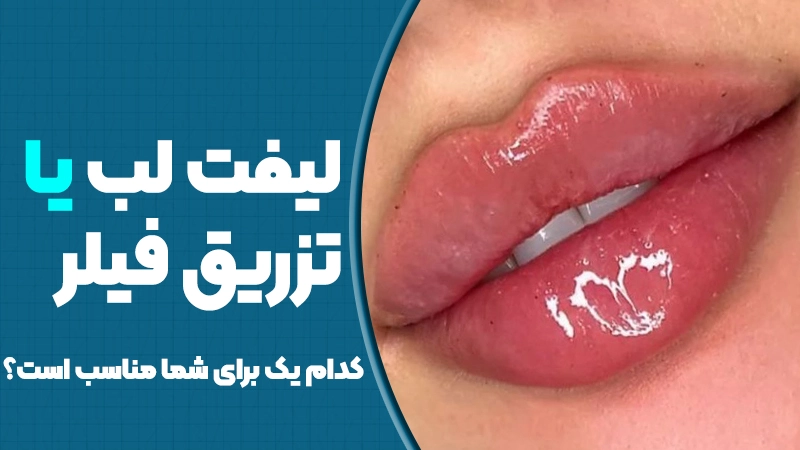 لیفت لب یا تزریق فیلر؛ کدام یک برای شما مناسب است؟