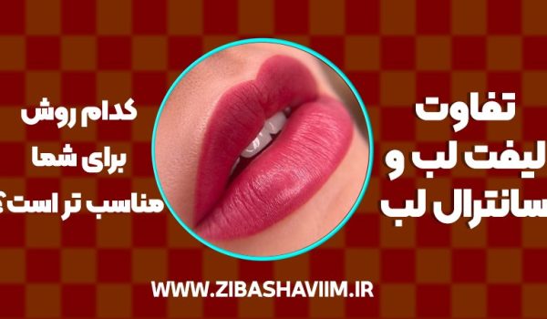 تفاوت لیفت لب و سانترال لب؛ کدام روش برای شما مناسب‌تر است؟