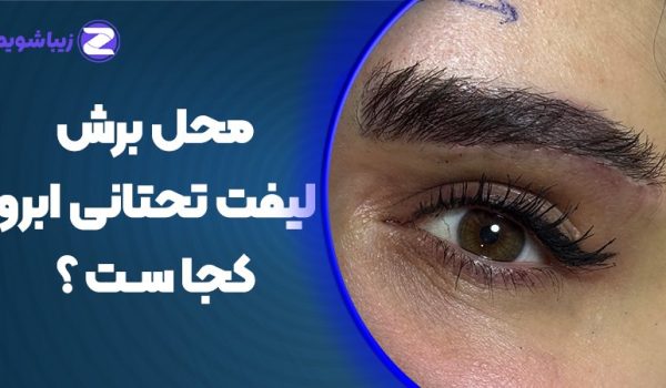 محل برش لیفت تحتانی ابرو کجاست؟