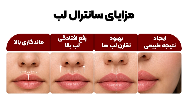 لیفت سانترال لب (بول هورن) چیست؟ 3 مزایای سانترال لب