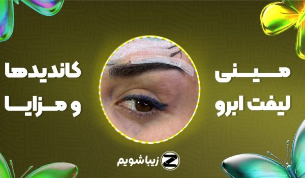 مینی لیفت ابرو؛ کاندیدها و مزایا