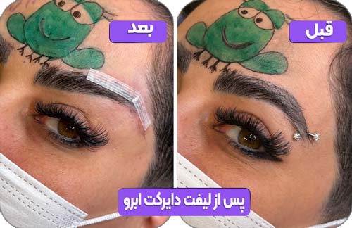 صفحه اصلی 38 پس از لیفت دایرکت ابرو 2