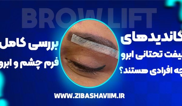 کاندیدهای لیفت تحتانی ابرو چه افرادی هستند؟ بررسی کامل فرم چشم و ابرو 1 کاندیدهای لیفت تحتانی ابرو چه افرادی هستند؟ بررسی کامل فرم چشم و ابرو