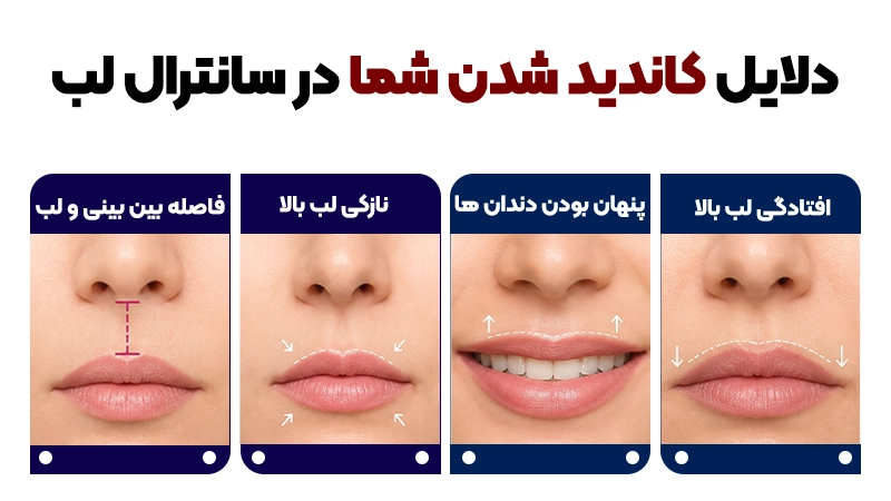 لیفت سانترال لب (بول هورن) چیست؟ 2 کاندیدهای مناسب سانترال لب