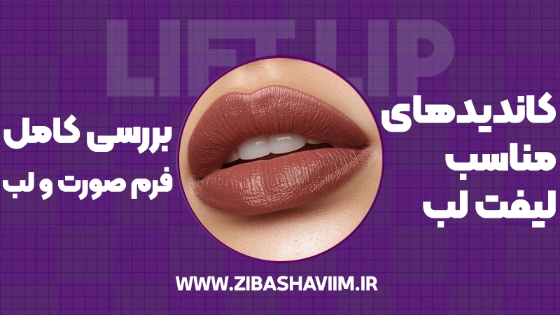 کاندیدهای مناسب لیفت لب؛ بررسی کامل فرم صورت و لب