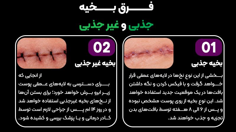 برای لیفت تحتانی ابرو از چه نوع نخ بخیهای استفاده میشود؟ 2 IMG 20260928 170035 920