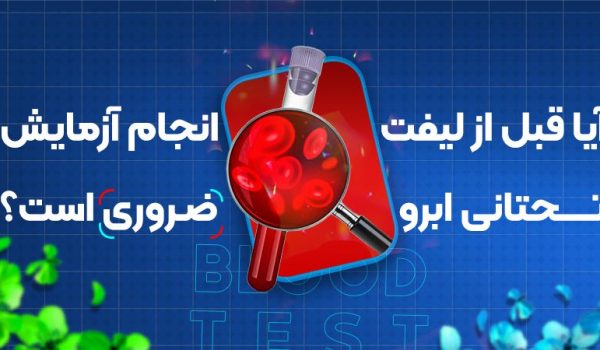 آیا قبل از لیفت تحتانی ابرو انجام آزمایش ضروری است؟