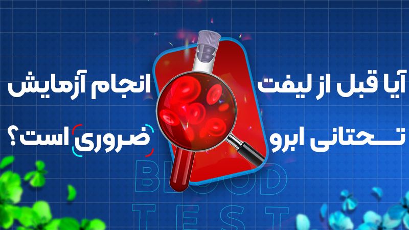 آیا قبل از لیفت تحتانی ابرو انجام آزمایش ضروری است؟
