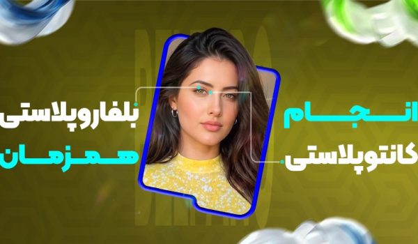 انجام کانتوپلاستی+ بلفاروپلاستی همزمان