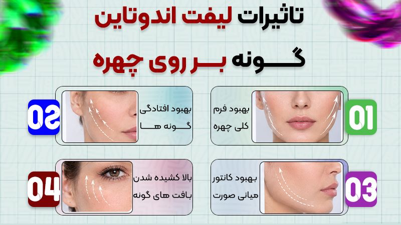 لیفت اندوتاین یا لیفت آندوسکوپیک گونه؟ کدام روش پیشنهاد میشود؟ 1 لیفت اندوتاین گونه و تاثیر بر روی چهره