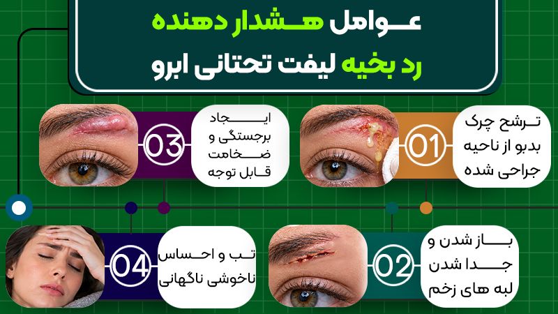 رد بخیه لیفت تحتانی ابرو چه زمانی محو میشود؟ 2 علائم هشدار دهنده رد بخیه لیفت تحتانی ابرو