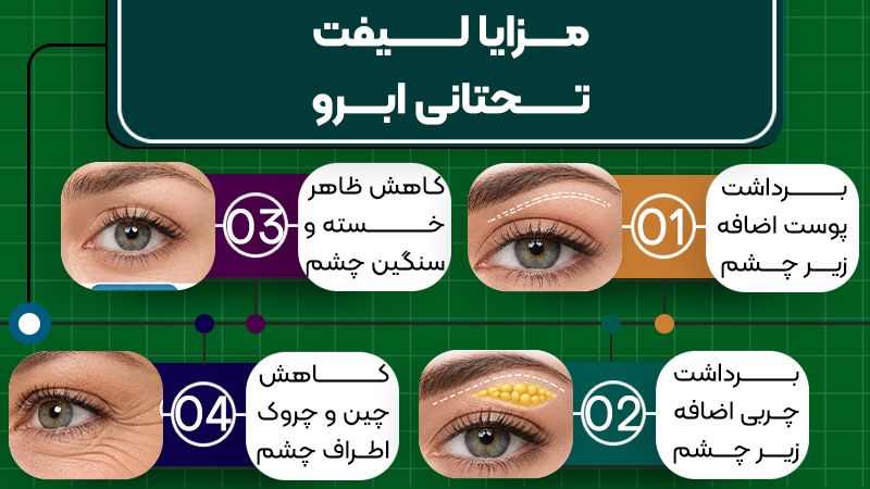 آیا لیفت تحتانی ابرو فاصله ابرو تا پلک را افزایش میدهد؟ 1 آیا لیفت تحتانی ابرو، ابرو را بالا میبرد؟