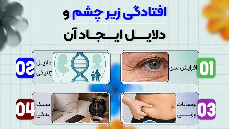 اگر پف و افتادگی زیر چشم داشتیم؛ کدام را اول برطرف کنیم؟ 2 افتادگی زیر چشم و دلایل ایجاد آن