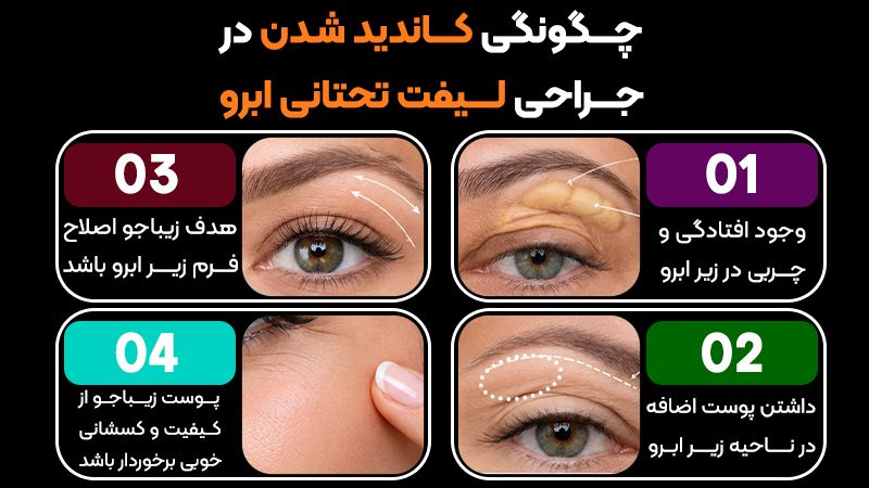 در جلسه مشاوره لیفت تحتانی ابرو چه مواردی بررسی میشود؟ 2 چگونگی تعیین شدن کاندید بودن در جراحی لیفت تحتانی ابرو