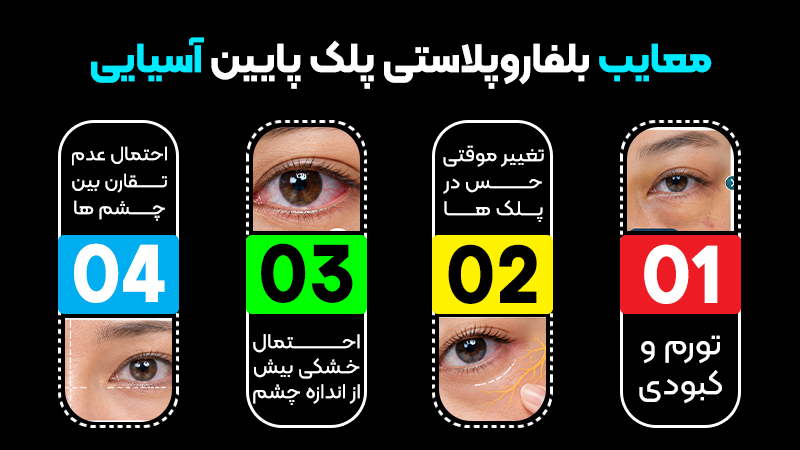 انجام بلفاروپلاستی پلک بالا آسیایی؛ مزایا و معایب 2 معایب بلفاروپلاستی پلک بالا آسیایی