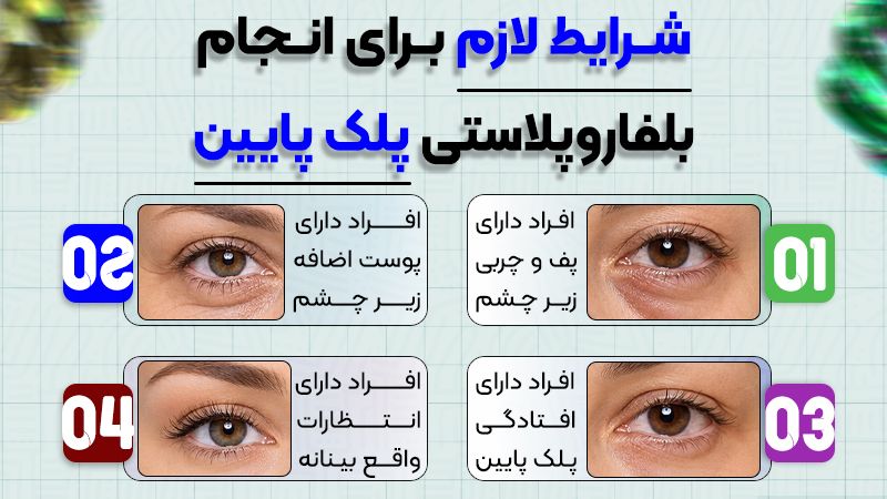 بررسی کامل کاندیدهای بلفاروپلاستی پلک پایین 1 شرایط لازم برای انجام بلفاروپلاستی پلک پایین