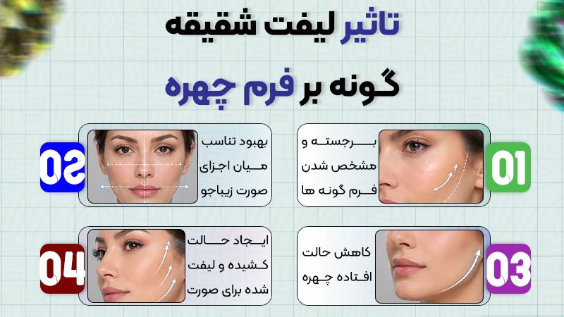 تاثیر لیفت شقیقه و گونه بر روی چهره 1 تاثیر لیفت شقیقه و گونه بر فرم چهره