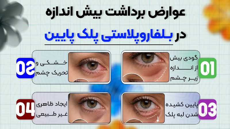 عوارض برداشت بیش از اندازه در بلفاروپلاستی پلک پایین