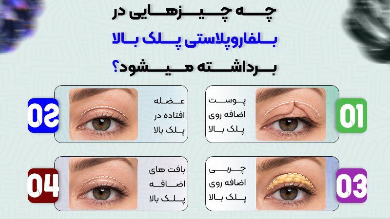 در بلفاروپلاستی پلک بالا چه چیزی برداشته میشود؟ 1 چه چیزهایی در بلفاروپلاستی پلک بالا برداشته میشود؟