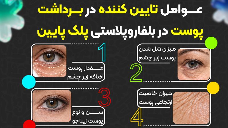 عوامل تعیین کننده در برداشت پوست در بلفاروپلاستی پلک پایین