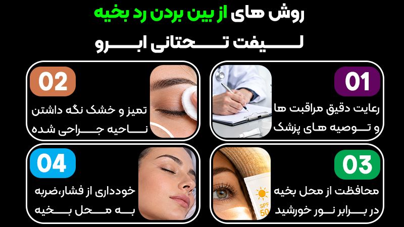 رد بخیه لیفت تحتانی ابرو چه زمانی محو میشود؟ 1 راهکارهای از بین بردن رد بخیه لیفت تحتانی ابرو