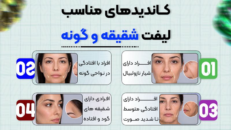 صفر تا صد لیفت شقیقه و گونه؛ مزایا و معایب 1 کاندیدهای مناسب لیفت شقیقه و گونه