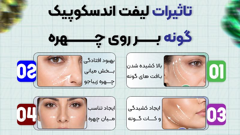 لیفت اندوتاین یا لیفت آندوسکوپیک گونه؟ کدام روش پیشنهاد میشود؟ 2 لیفت آندوسکوپیک گونه و تاثیر بر روی چهره