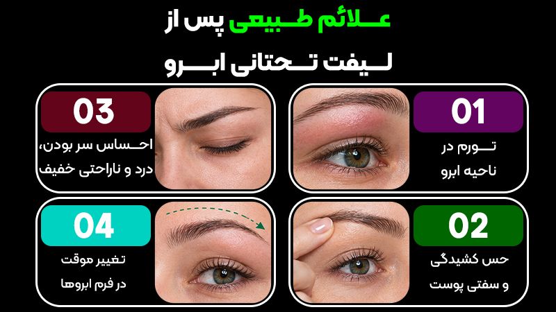 چه علائمی بعد از لیفت تحتانی ابرو نیاز مراجعه فوری به پزشک دارد؟ 2 بیشتر بخوانید: آیا جراحی لیفت تحتانی ابرو باعث ریزش ابرو میشود؟