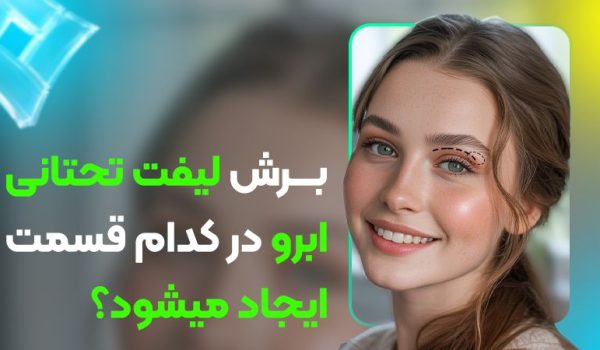 برش لیفت تحتانی ابرو در کدام قسمت ایجاد می‌شود؟