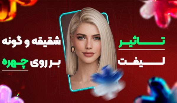 تاثیر لیفت شقیقه و گونه بر روی چهره