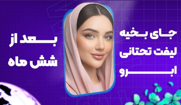 جای بخیه لیفت تحتانی ابرو بعد از شش ماه