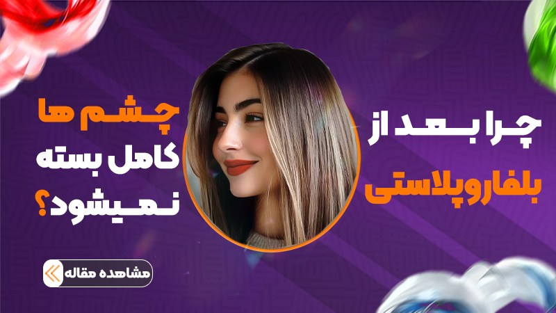چرا بعد از بلفاروپلاستی چشمها کامل بسته نمیشوند؟