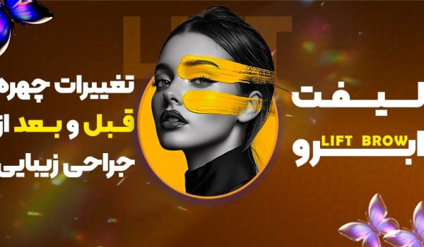 لیفت ابرو؛ تغییرات چهره قبل و بعد از جراحی زیبایی