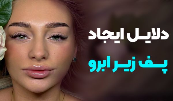 دلایل ایجاد پف زیر ابرو؛ راهکارهای دائمی رفع آن
