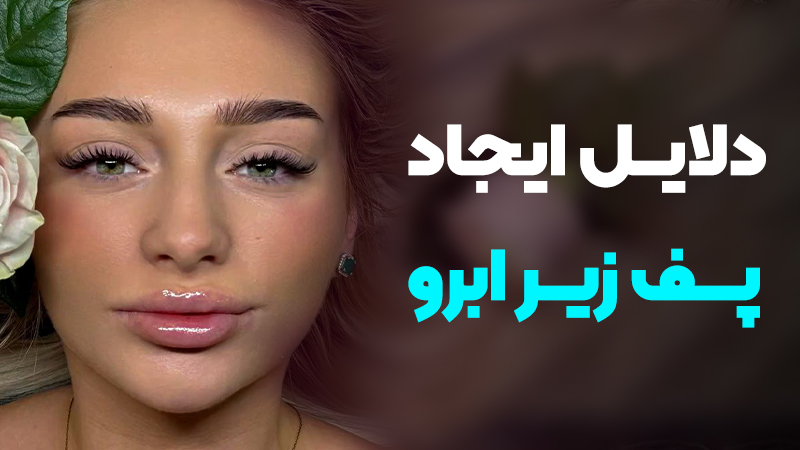 دلایل ایجاد پف زیر ابرو؛ راهکارهای دائمی رفع آن