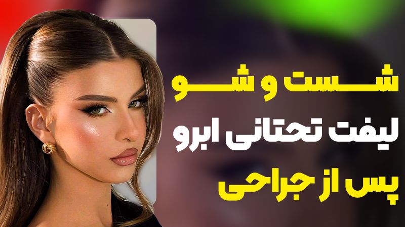 آیا بعد از لیفت تحتانی ابرو میتوان محل جراحی را شست؟