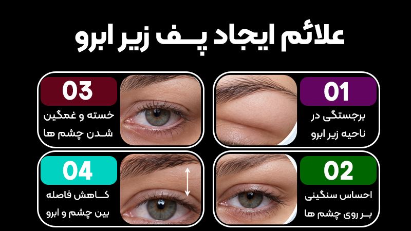 پف زیر ابرو دارم یا افتادگی پلک؟ از کجا بفهمیم؟ 1 علائم ایجاد پف زیر ابرو